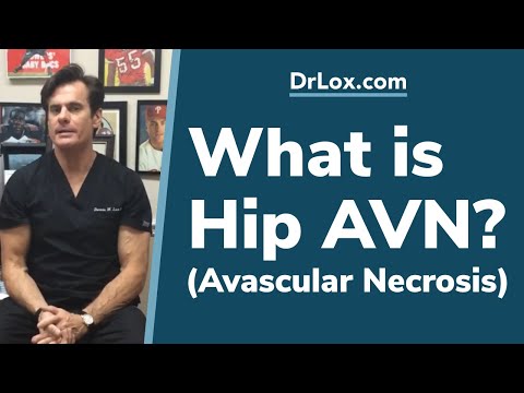 What is Hip AVN? Dr. Lox Explains Avascular Necrosis of Hip