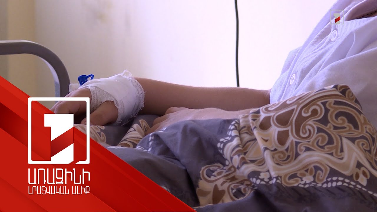 Կարմրուկ ախտորոշմամբ Հայաստանում երեխա է մահացել. մասնագետների հորդորը