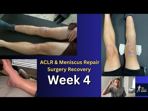 ACL and Meniscus Surgery | Week 4 Post Op