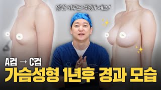 A컵에서 C컵으로... 가슴 수술 후 1년이 경과하면 어떤 모습일까? 실제 사례자 사진 대공개!