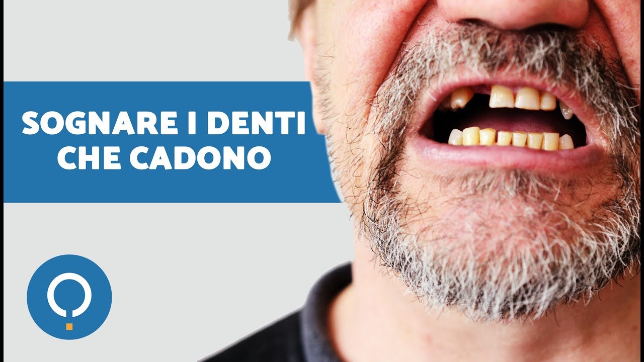 Sognare i DENTI CHE CADONO - Significato dei sogni