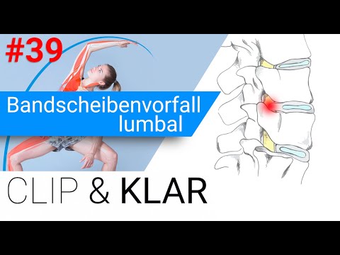 Lumbaler Bandscheibenvorfall erklärt - Beinschmerz mit und ohne Lähmung