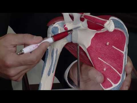 Shoulder Dislocation