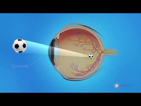 How the Eye Works