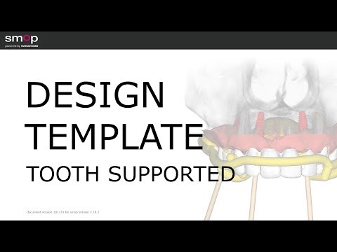 DesignTemplate ToothSupported 181117