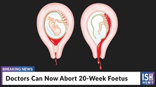 Doctors Can Now Abort 20-Week Foetus