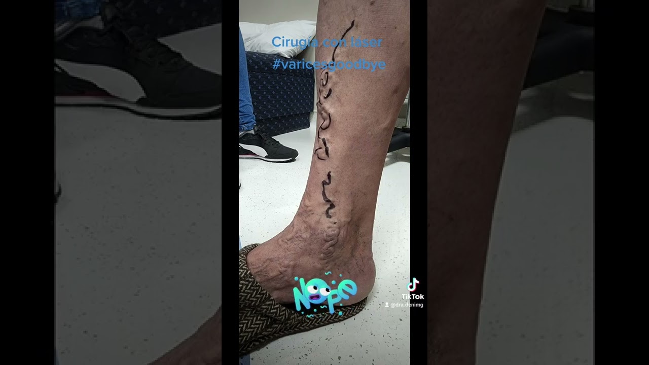 Deni Martínez Gama-20