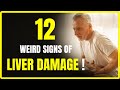 12 Weird Signs of Liver Damage | Nutrirevitalize