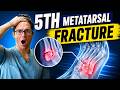 5th Metatarsal Jones Fracture [Recovery, Treatment & Surgery]