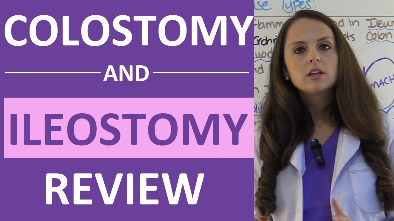 What is the difference between an ileostomy and a colostomy? Tipseri