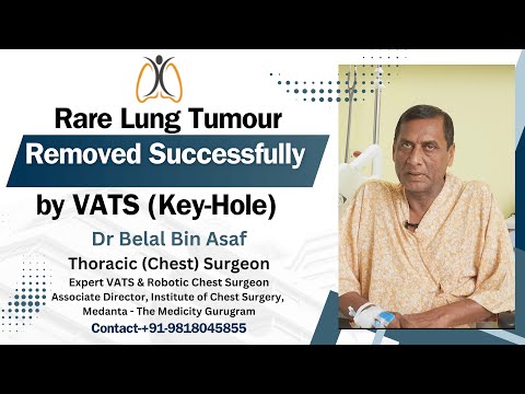 "Frequent Hiccups Reveal Rare Lung Tumor | VATS Wedge Resection Success in Lung Nodule Treatment"