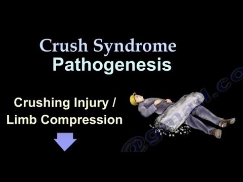 "Crush Syndrome", Lésions dues aux Tremblements de Terre 