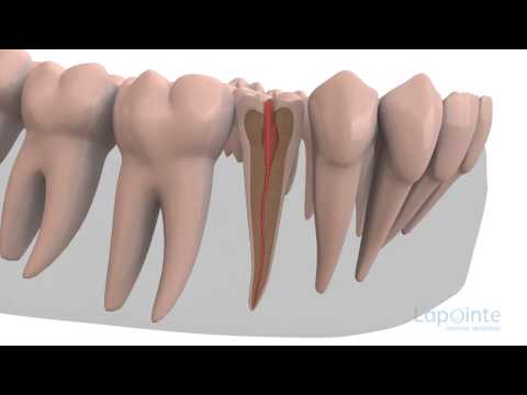 comment soigner espace entre les dents
