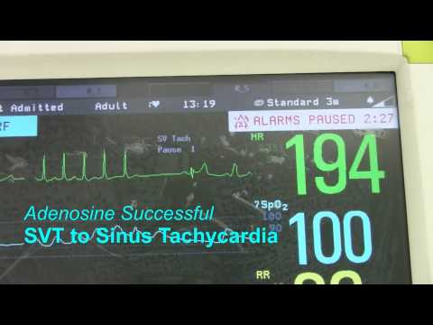SVT oder supraventrikuläre Tachykardie