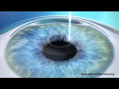 Maschera e persona di un molchalin Come completamente si libererà da borse sotto occhi