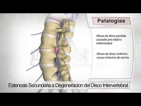 Pietroburgo, con il funzionamento dellarticolazione del ginocchio Segni di malattia di malattia delle articolazioni