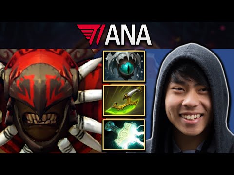 Bloodseeker Dota 2 Gameplay T1.Ana with Crazy 31 Kills