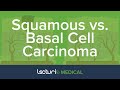 Squamous Cell Carcinoma SCC Vs Basal Cell Carcinoma BCC Dermatology