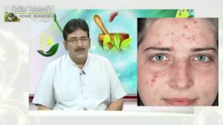 Cure Skin Problems with Baking Soda - Hakim Suleman Khan (खाने वाले सोडा से दूर करें चर्म रोग)