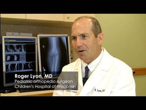 How growth plates impact broken bones in children