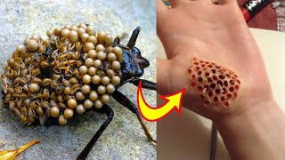15 Most Dangerous Bugs in the World