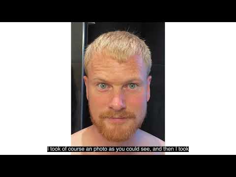 Review of Scandinavian Biolabs Hair Growth Routine for...