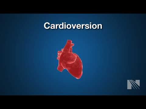 Cardioversion Procedure: Returning a heartbeat to normal rythm