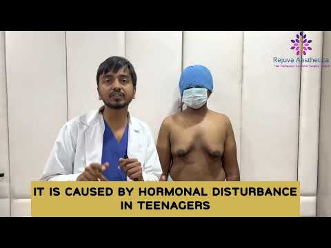 Can Teenage gynecomastia be cured by exercising, proper diet and Medication ? #shorts #gynecomastia