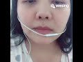 Cover แพ้ทาง