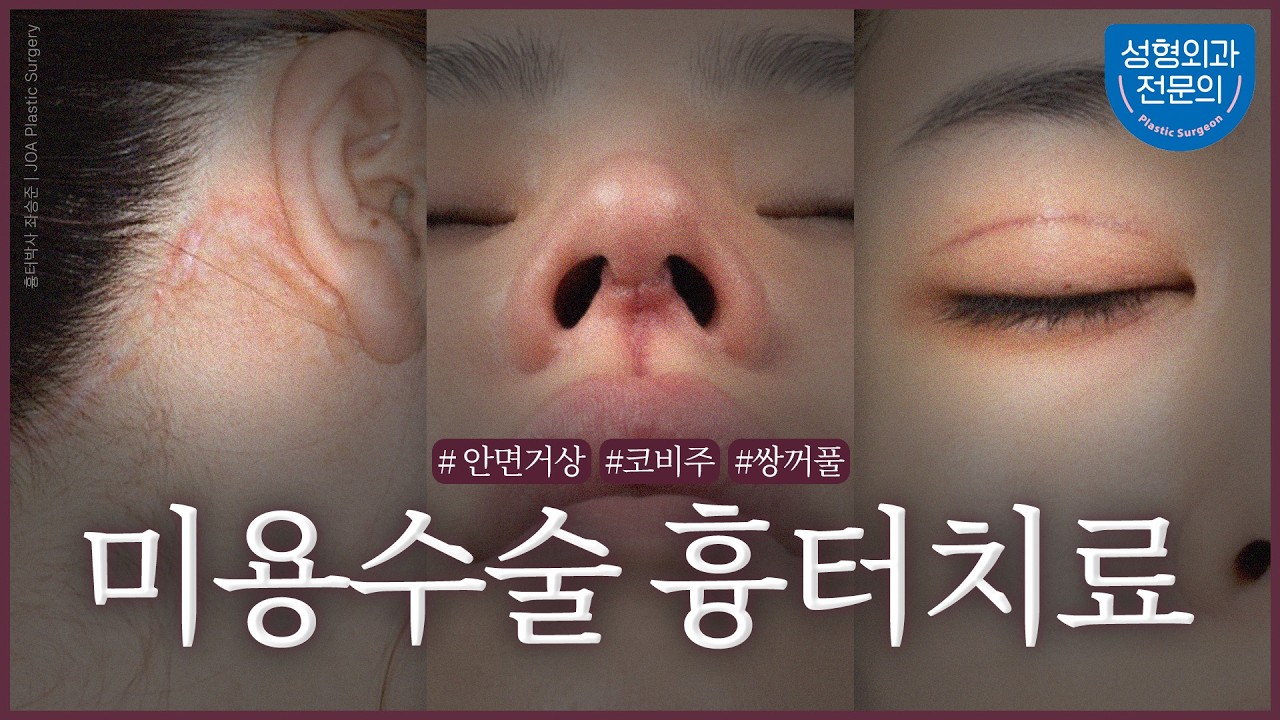 동영상 썸네일