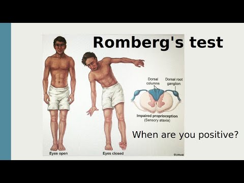 Romberg's test