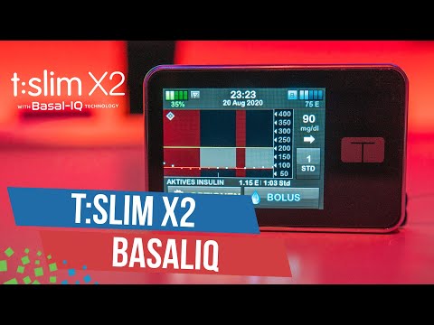 Nie wieder Unterzuckerungen? BasalIQ der t:slim X2 - (Review/Meine Erfahrungen)