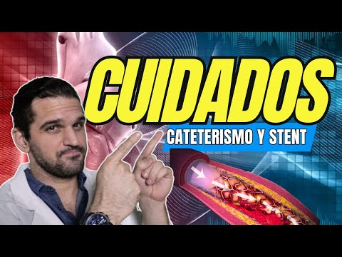 ¡Después del Stent: Cuidados CRUCIALES para tu Corazón! 💯