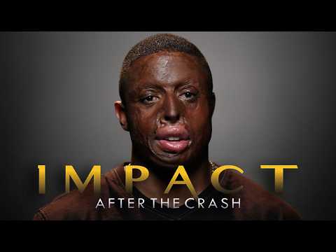 Impact After The Crash (2017) | Full Movie | Documentary