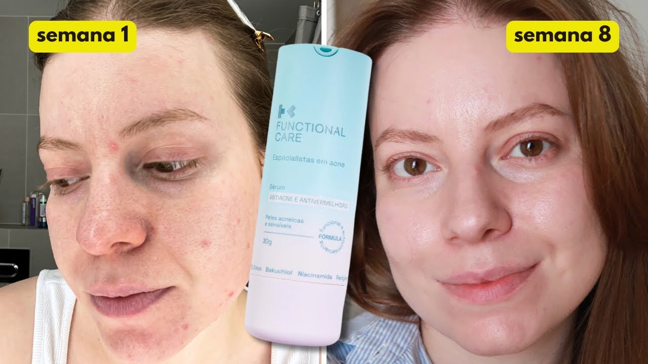 Testei o Sérum da Functional Care por 60 Dias, duas vezes ao dia: Resultados REAIS!