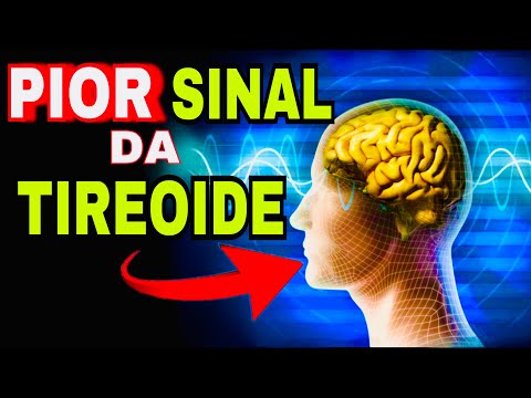 7 SINAIS PERIGOSOS do HIPERTIREOIDISMO (Sintomas da Tireoide Produzindo Muitos Hormônios T3 e T4)