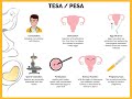 TESA and PESA recovered good number of sperms