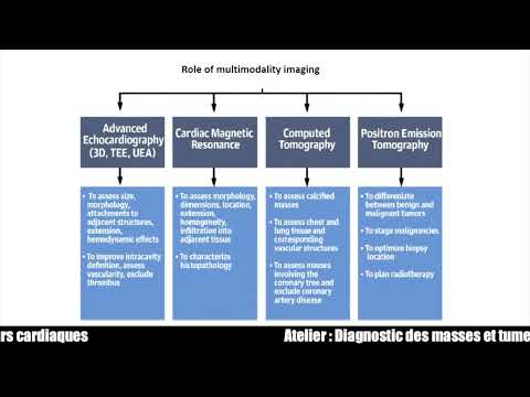 Diagnostic des masses et tumeurs cardiaques
