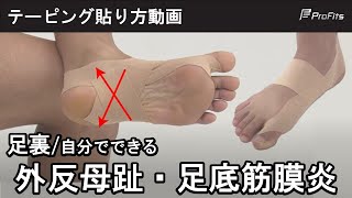 足底筋膜炎などの予防に！足裏アーチのテーピング