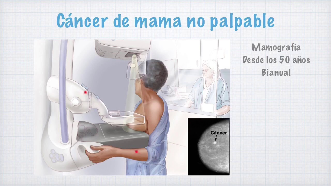Cáncer de mama
