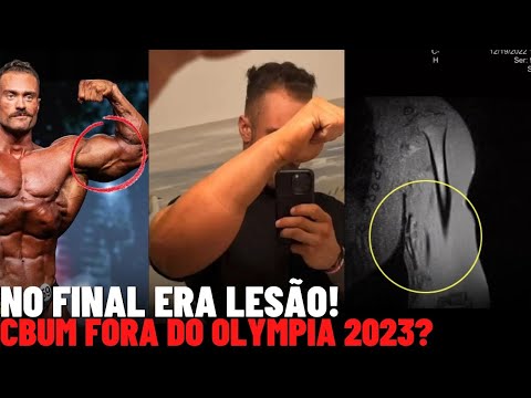 O QUE ACONTECEU NO BRAÇO DO CBUM E O QUE PODE ACONTECER