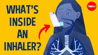 How exactly do inhalers work? - Anna Rothschild
