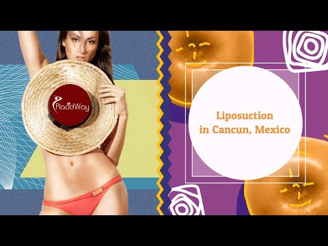 Important Things to Know Before Considering Liposuction in Cancun, Mexico