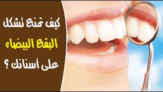 كيف تمنع تشكل البقع البيضاء على أسنانك ؟ كيف تمنع تشكل البقع البيضاء على أسنانك ؟