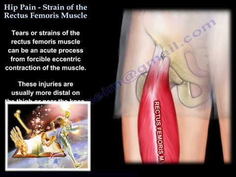 Agent anestezic și antiinflamator pentru osteochondroză