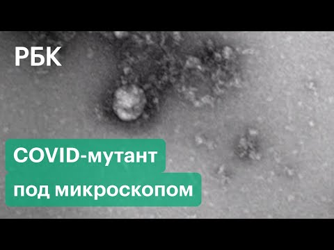 Фото нового штамма коронавируса. Опасность, скорость распространения и эффективность вакцины