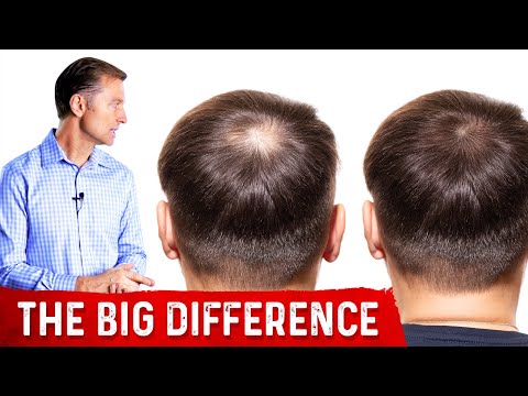 Why PROTEIN Does Not Help Hair Loss Brittle Nails and Collagen Loss – Dr Berg