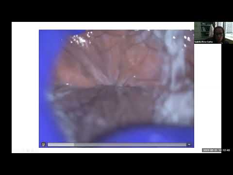 Grand Rounds 2023.05.31