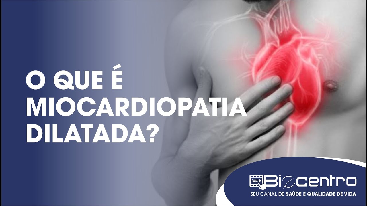 O que é miocardiopatia dilatada