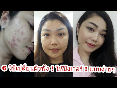 Exciter สำหรับการดำเนินการอย่างรวดเร็วของผู้หญิงในยูเครน ขยายขนาดอวัยวะเพศผ่าตัด